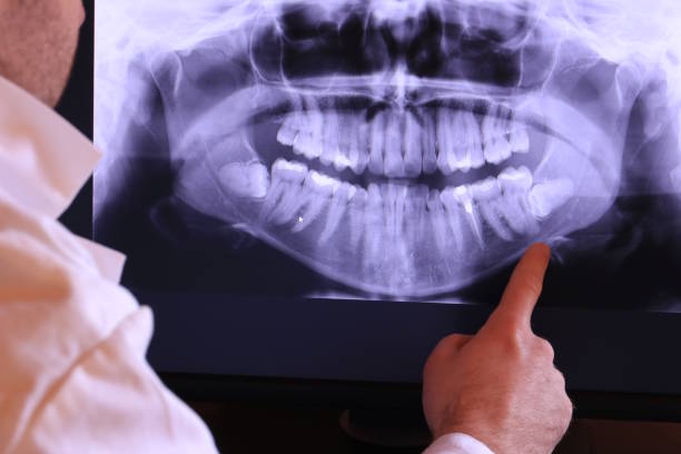 Best After-Hours Dental Trauma Care in Dryden, MI