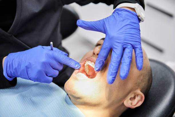 Best Emergency Root Canal Treatment in Dryden, MI